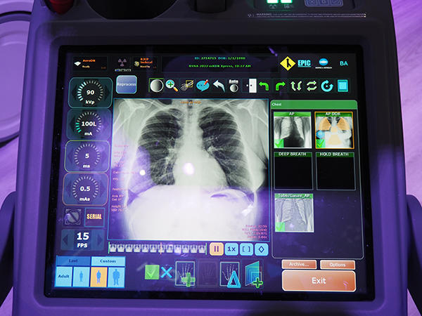 米国でも注目を集めるX線動態撮影（Dynamic Digital Radiography）