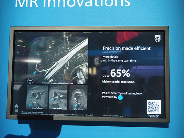 神経叢が細部まで分析可能となり，研究に応用されている。