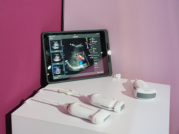 携帯型装置「Lumify」とプローブラインアップ