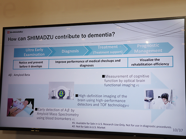 計測技術と画像診断技術で認知症診療への貢献をめざす