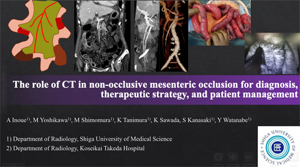 EREE-50 The Role of CT in Non-occlusive Mesenteric Occlusion for Diagnosis, Therapeutic Strategy, and Patient Management 井上明星 氏（滋賀医科大学）ほか