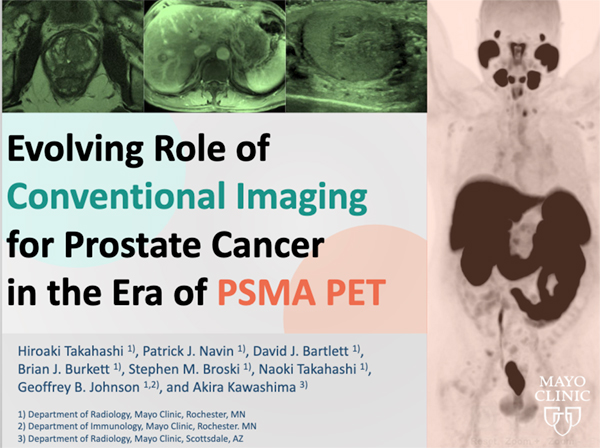 GUEE-84 Evolving Role of Conventional Imaging for Prostate Cancer in the Era of PSMA PET 高橋宏彰 氏（メイヨークリニック）ほか