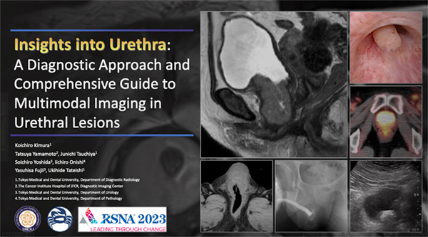 GUEE-93 Insights into Urethra: A Diagnostic Approach and Comprehensive Guide to Multimodal Imaging in Urethral Lesions  木村浩一朗 氏（東京医科歯科大学）ほか