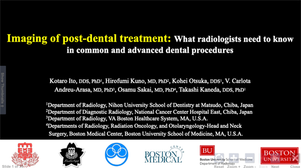 HNEE-77  Imaging of Post-dental Treatment: What Radiologists Need to Know in Common and Advanced Dental Procedures 伊東浩太郎 氏（日本大学松戸歯学部）ほか