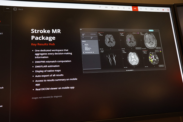 「Stroke MR Package」を米国でも提供開始