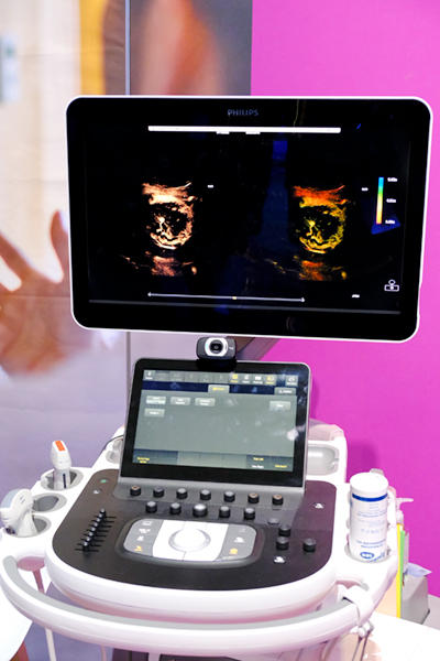 据え置き型ハイエンド装置「EPIQ Elite」のversion 10