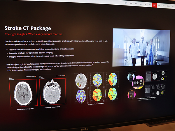 脳卒中トリアージソリューション「Stroke CT Package」