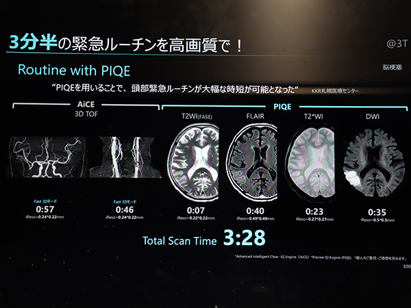 救急におけるPIQEの適用