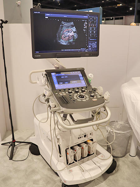 Aplio i 800のデモンストレーション展示を実施