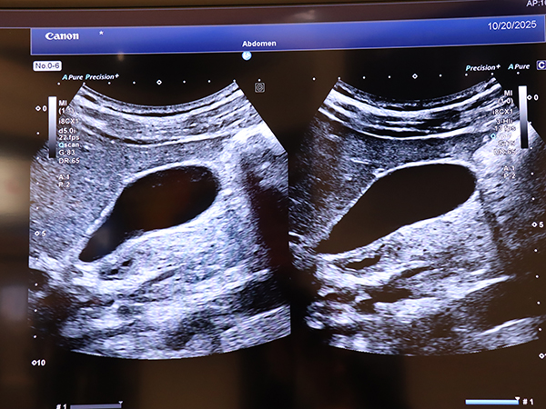 「3-HI」（右）では管腔と組織の境界がよりシャープに描出され，管腔内の抜けもクリアになる