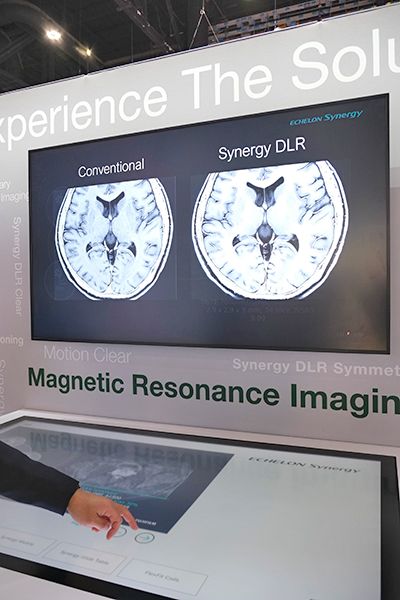 ECHELON Synergyに搭載されたノイズ除去技術「Synergy DLR」を紹介