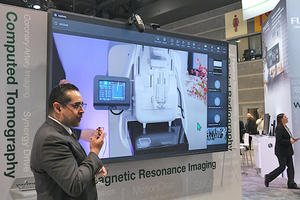 デジタルマンモグラフィシステム「AMULET SOPHINITY」