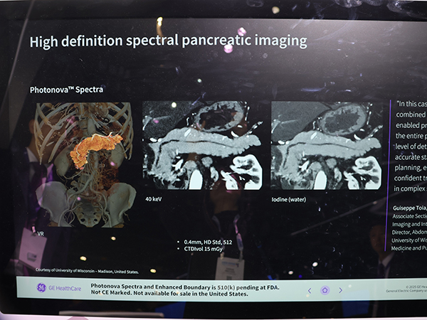 スペクトラルイメージングでのメリットが期待される「Photonova Spectra」（薬機法未承認）