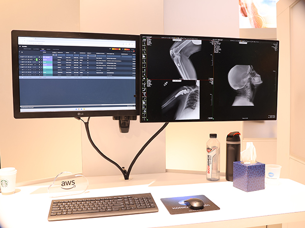 「exa PACS | RIS」のビューワ画面