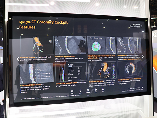 PCIを支援する「syngo.CT Coronary Cockpit」（W.I.P.）