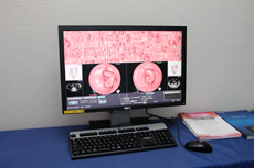 アミン株式会社/ザイオソフト株式会社