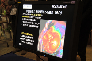 ziostation2を紹介したザイオソフト