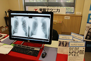 東陽テクニカは，胸部X線骨組織透過ソリューション“Clear Read BS”シリーズを展示。1枚の画像から骨抜きが可能なほか，経時差分（＋Compare）機能も利用可能