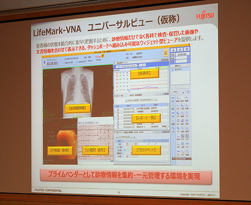 開発が進むHOPE LifeMark-VNA（仮称）の専用ビューワ「ユニバーサルビュー（仮称）」