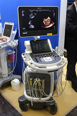 S8-3tなどのトランスジューサに対応し，リアルタイム3D表示機能を追加した「Affiniti 70G Continuum 1.0」