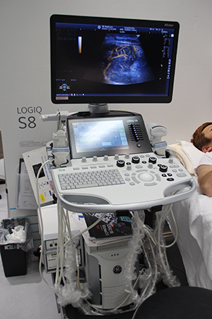 汎用超音波診断装置のハイエンド機種である「LOGIQ S8 with XDclear」。重量85kgとコンパクト設計でバッテリー駆動にも対応。OLED（有機ELディスプレイ）を採用して視認性を向上。