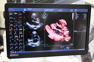 有機ELディスプレイの採用により，黒色の表示を大きく改善