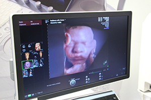 胎児の表情の変化をリアルタイムで観察できる