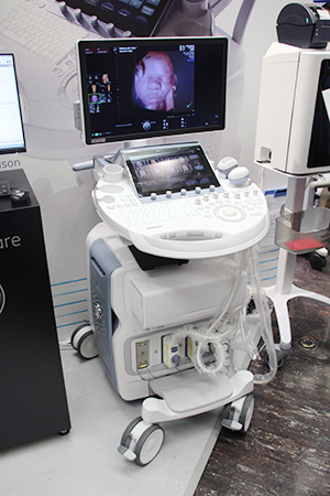 Electronic4Dプローブを搭載し，3D・4Dによる高精細な胎児の診断を可能にする「Voluson E10」