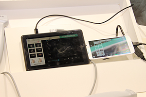 Sonosite iVizとスマートフォンを接続すると，専用アプリケーションが起動する