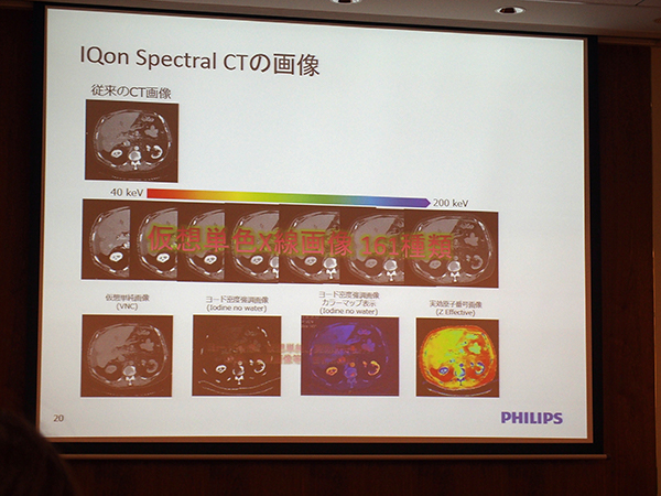 IQonスペクトラルCTで得られる169種類の画像