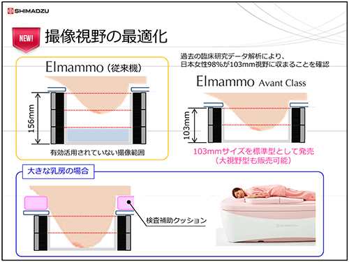 日本人女性に合わせた検出器の最適化