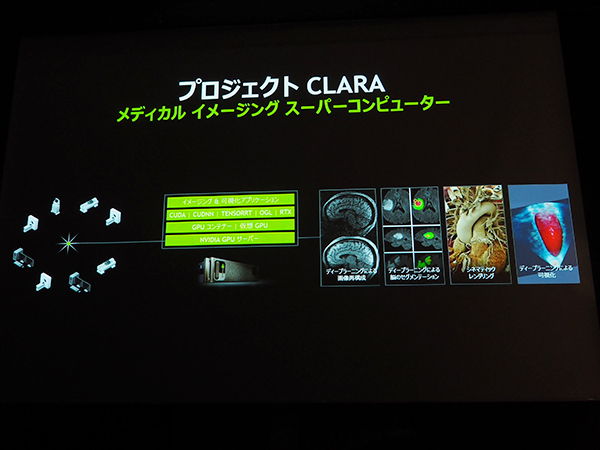 医療画像診断スーパーコンピュータによる「CLARAプロジェクト」