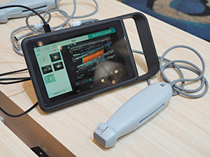 タブレット型超音波診断装置「Sonosite iViz」