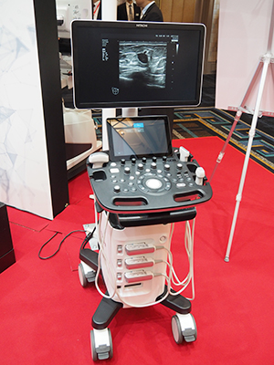 ミドルクラスの超音波診断装置の新製品「FUTUS」を参考出展