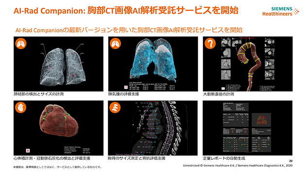 AI-Rad Companionの胸部CT画像AI解析受託サービス