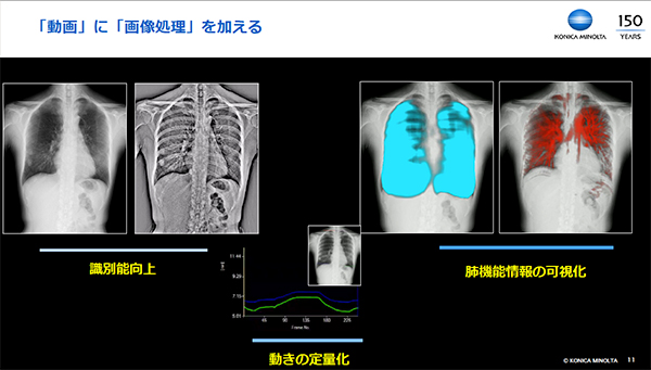 動態解析により多くの肺機能情報を提供するX線動態解析システム（コニカミノルタ提供資料より）