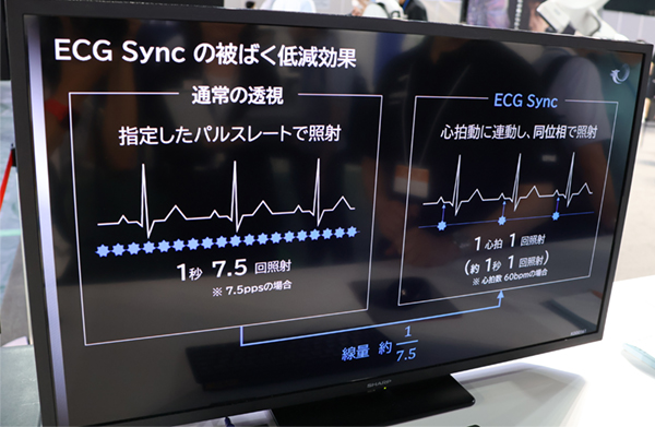 「ECG Sync」による被ばく低減効果