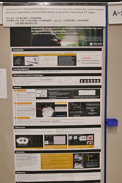 Certificate of Merit（国際部門） Development of retrospective respiratory gating reconstruction without the need for special devices or applications: using the time density curve of four-dimensional CT images 秋山宜行 氏（公立陶生病院）
