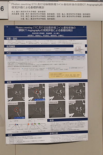 Certificate of Merit（臨床部門） Photon counting CTにおける脳動脈瘤コイル塞栓術後の頭部CT Angiographyの視覚評価による基礎的検討 井上廣介 氏（東京科学大学病院）