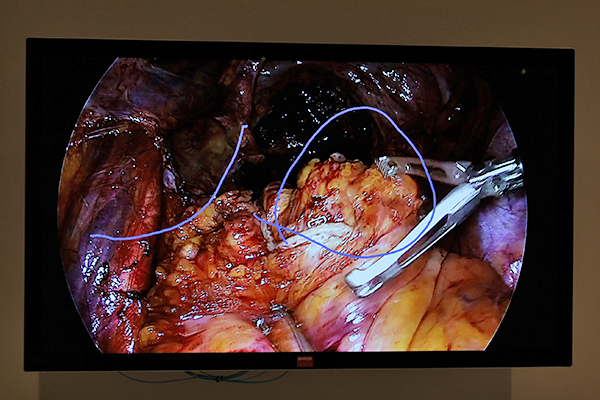 Nexxis2.0に追加されたブレンディング機能