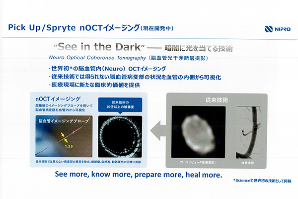 開発を進める光干渉断層撮影技術「Spryte nOCTイメージング」