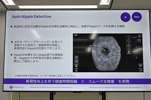 ニップルの位置を自動検出するAuto Nipple Detection