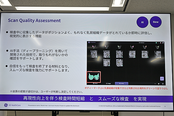撮像範囲やニップルの位置などを評価するScan Quality Assessment