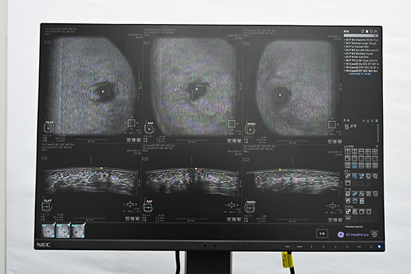 遠隔読影など多様なニーズに応えるワークステーション