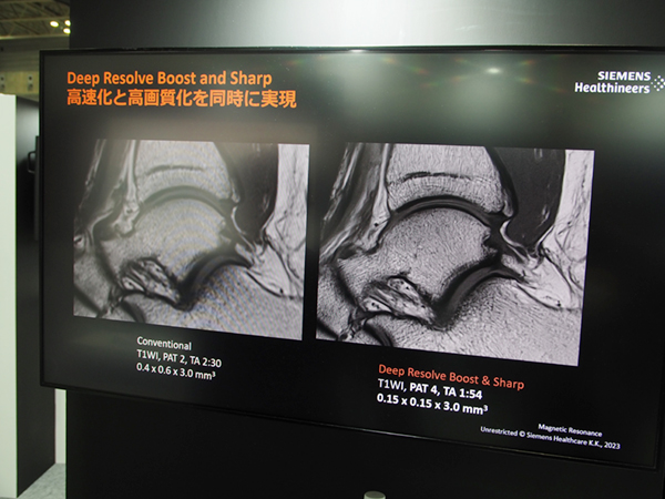 「Deep Resolve Boost」と「Deep Resolve Sharp」の併用で解像度向上と撮像時間短縮を両立 「Deep Resolve Boost」と「Deep Resolve Sharp」の併用で解像度向上と撮像時間短縮を両立