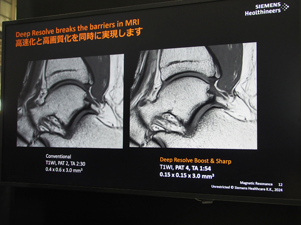 Deep Resolveを適用した画像例 Deep Resolveを適用した画像例