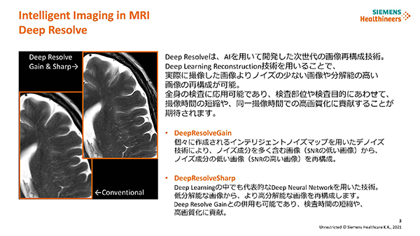 ディープラーニングによりノイズ低減,鮮鋭度向上を図る“Deep Resolve Gain”と“Deep Resolve Sharp” ディープラーニングによりノイズ低減,鮮鋭度向上を図る“Deep Resolve Gain”と“Deep Resolve Sharp”