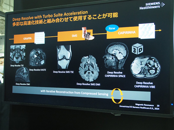 Deep Resolveを併用可能な高速化技術 Deep Resolveを併用可能な高速化技術