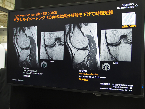 3D高速撮像へのDeep Resolve適用例 3D高速撮像へのDeep Resolve適用例